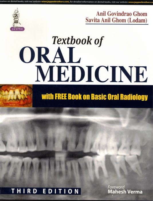 Textbook Of Oral Medicine By Anil Govindrao Ghom Savita Anil Ghom