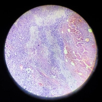 Online Pathology