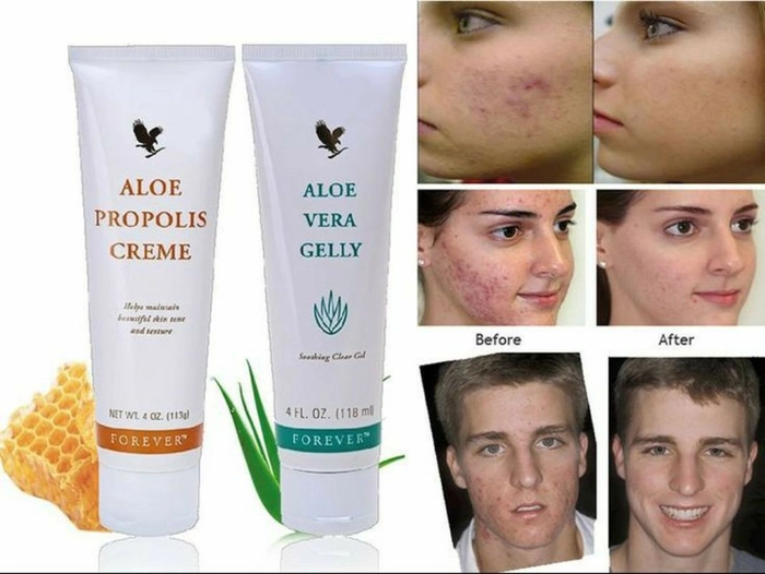 FOREVER ALOE VERA GELLY