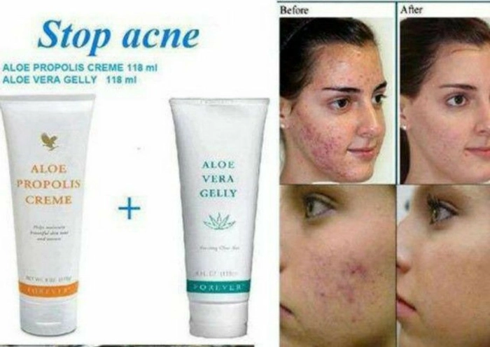 FOREVER ALOE VERA GELLY