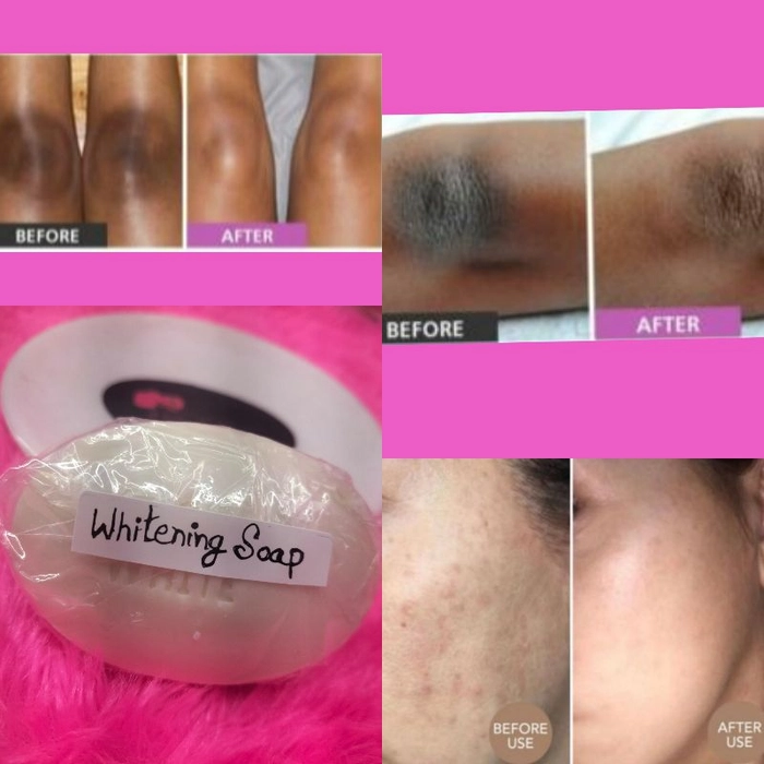 Whitening Soap