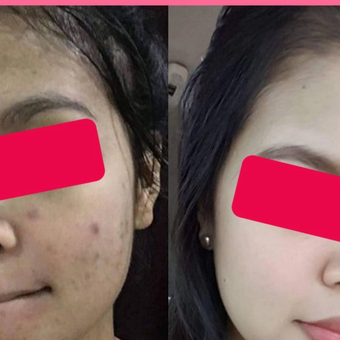 Whitening Day Cream