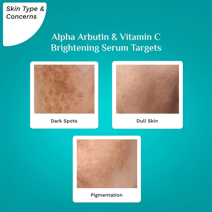 Alpha Arbutin & Vitamin C Brightening Serum