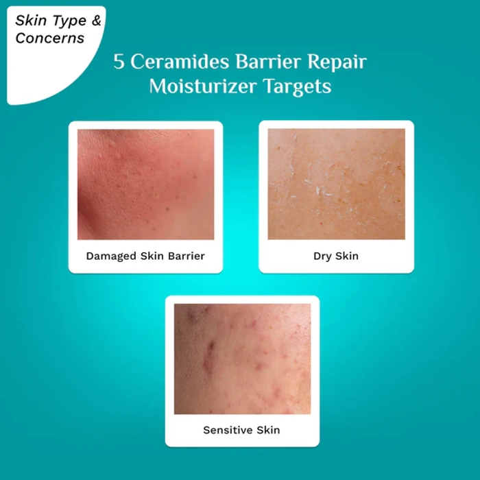 5 Ceramides Barrier Repair Moisturizer