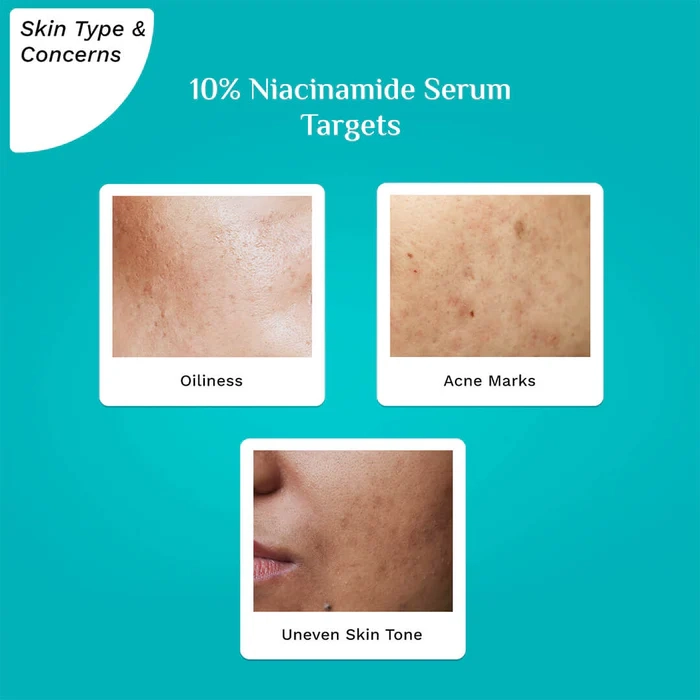 10% Niacinamide Face Serum For Acne Marks