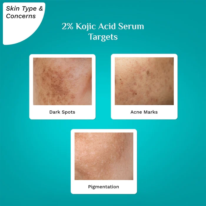 2% Kojic Acid Serum