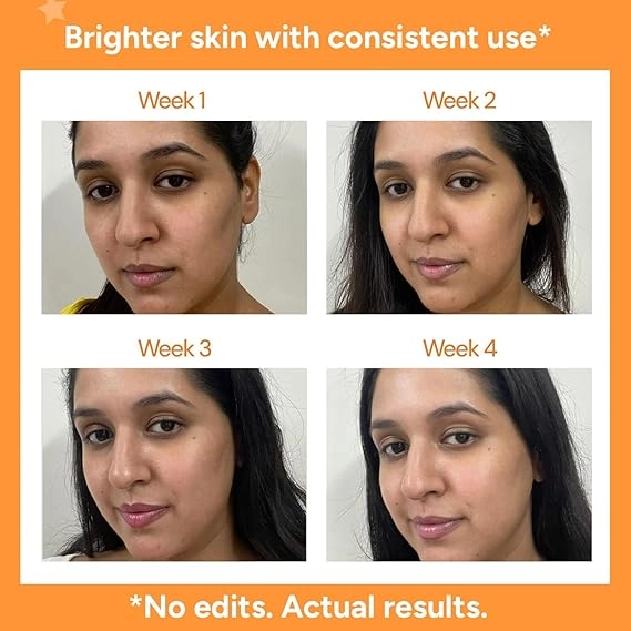 Trucee Vitamin C Face Brightening Serum With Kakadu Plum, 10% Ascorbic Acid | Best Serum For Acne-Prone Skin | For All Skin Types- 30ml