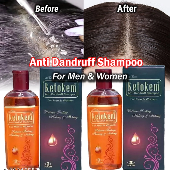 Ketokem- Anti Dandruff Shampoo for Men & Women manufactured by Alkem- Pack of 2