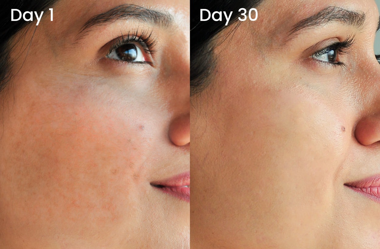 results proof of foxtale mattifying sunscreen